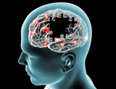 Taking Care of a Loved One With Alzheimer's: Resources for Caregivers